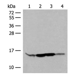 RPP14 rabbit polyclonal antibody