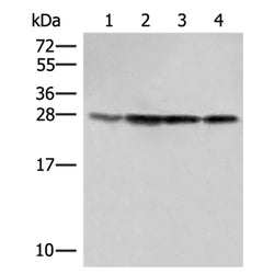 SEC22B rabbit polyclonal antibody