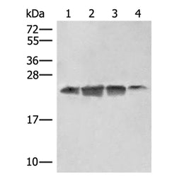EIF3K rabbit polyclonal antibody
