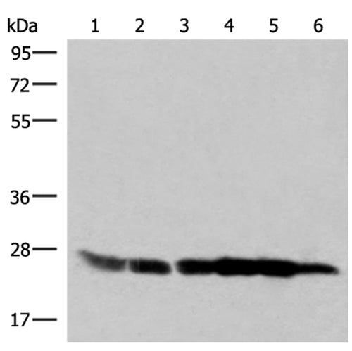 GSTK1 rabbit polyclonal antibody