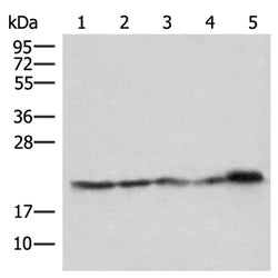 ATP5PD rabbit polyclonal antibody