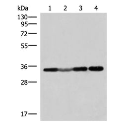 ECH1 rabbit polyclonal antibody