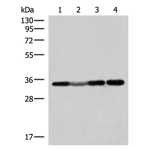 ECH1 rabbit polyclonal antibody