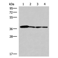 ELAC1 rabbit polyclonal antibody