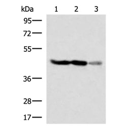 FDFT1 rabbit polyclonal antibody