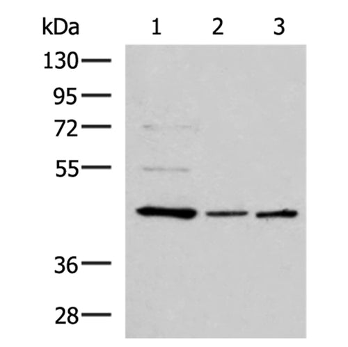 ACTL6B rabbit polyclonal antibody