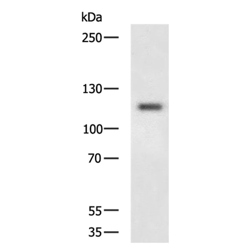 GRIA1 rabbit polyclonal antibody