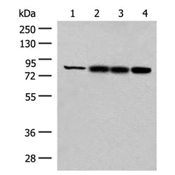 HNF1A rabbit polyclonal antibody