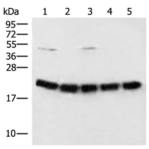 ARF5 rabbit polyclonal antibody