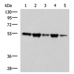 FKBP5 rabbit polyclonal antibody