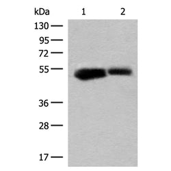 GLUD1 rabbit polyclonal antibody