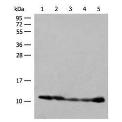 ATP5ME rabbit polyclonal antibody