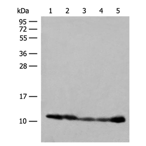 ATP5ME rabbit polyclonal antibody
