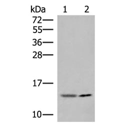 GUCA2A rabbit polyclonal antibody