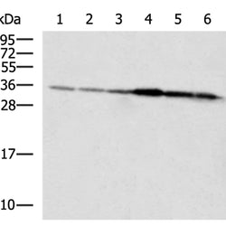 HADH rabbit polyclonal antibody