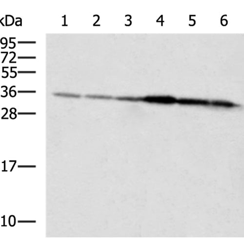 HADH rabbit polyclonal antibody