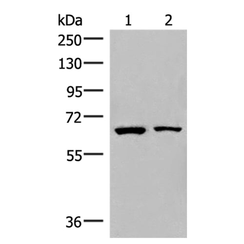 ZNF85 rabbit polyclonal antibody