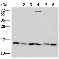 TRMT112 rabbit polyclonal antibody