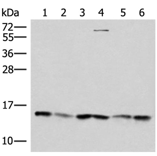 TRMT112 rabbit polyclonal antibody