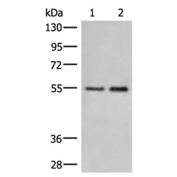 HTRA4 rabbit polyclonal antibody