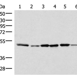 IP6K1 rabbit polyclonal antibody