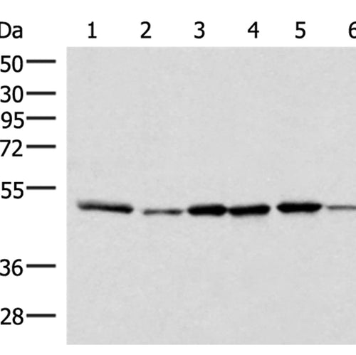 IP6K1 rabbit polyclonal antibody