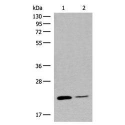RAC3 rabbit polyclonal antibody