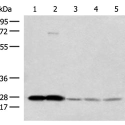 OVOL2 rabbit polyclonal antibody