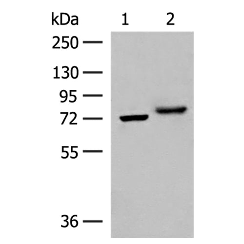 POMGNT1 rabbit polyclonal antibody
