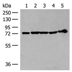 CALCOCO1 rabbit polyclonal antibody