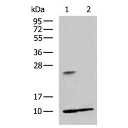 RPS27A rabbit polyclonal antibody