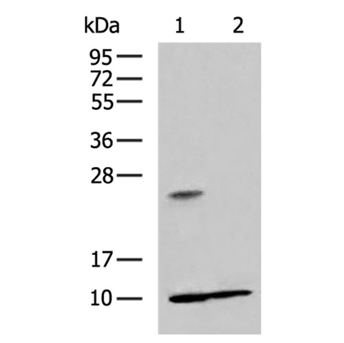 RPS27A rabbit polyclonal antibody