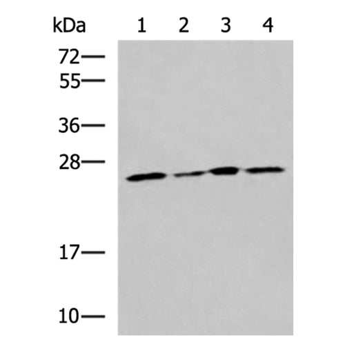 RPL13A rabbit polyclonal antibody