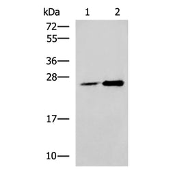 DGCR6L rabbit polyclonal antibody