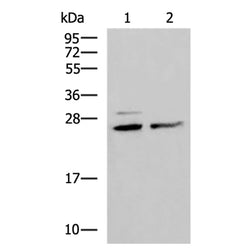 SNRPB2 rabbit polyclonal antibody
