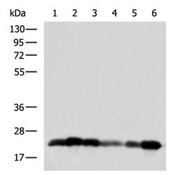 NEGR1 rabbit polyclonal antibody