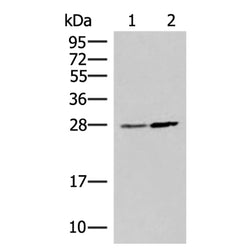 NAA10 rabbit polyclonal antibody