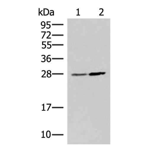 NAA10 rabbit polyclonal antibody
