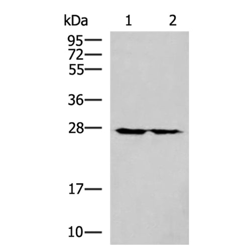 MRPL16 rabbit polyclonal antibody