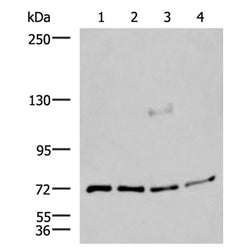 ASTE1 rabbit polyclonal antibody