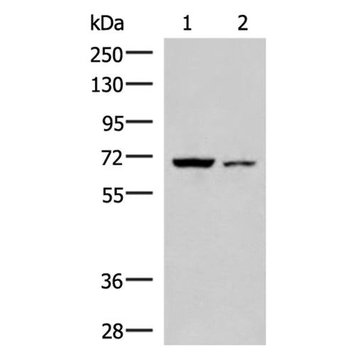 EWSR1 rabbit polyclonal antibody