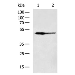 ABHD2 rabbit polyclonal antibody
