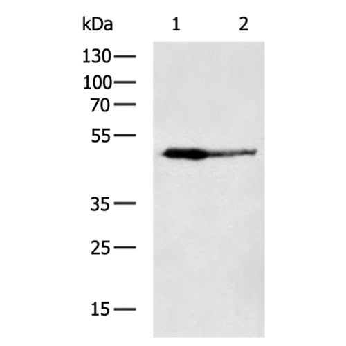 ABHD2 rabbit polyclonal antibody