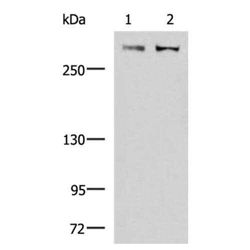 FLNC rabbit polyclonal antibody