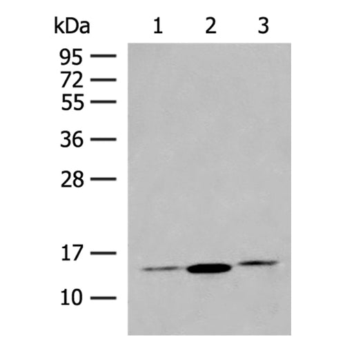 HBB rabbit polyclonal antibody