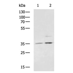 LDHA rabbit polyclonal antibody