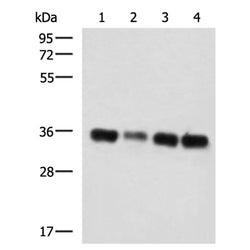 GRHPR rabbit polyclonal antibody