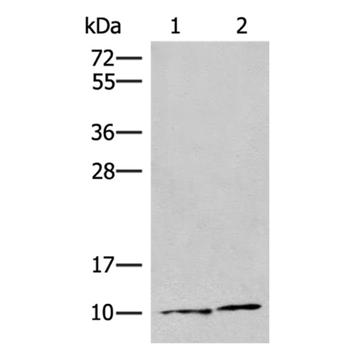 SNRPG rabbit polyclonal antibody