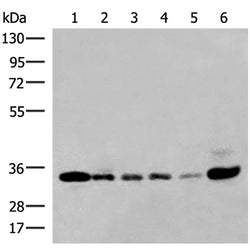 HNRNPA1L2 rabbit polyclonal antibody