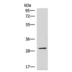 CDK4 rabbit polyclonal antibody